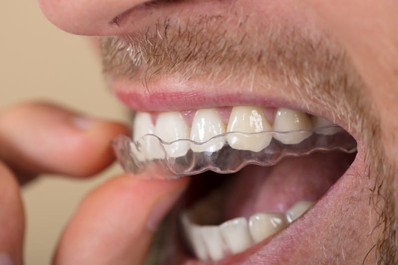 Dental treatment for TMJ