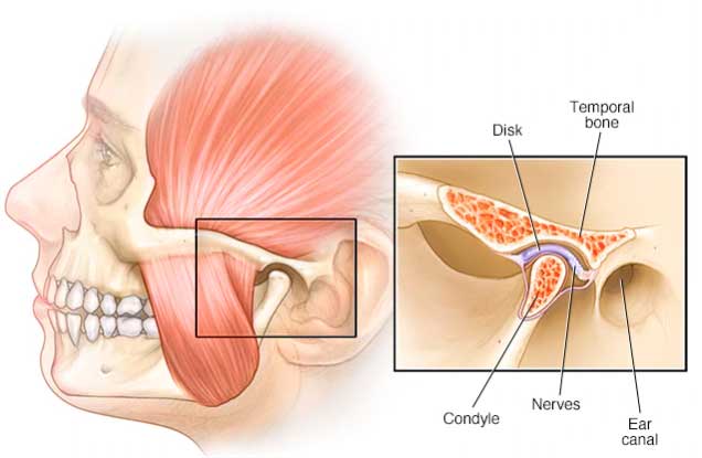 Causes of TMJ